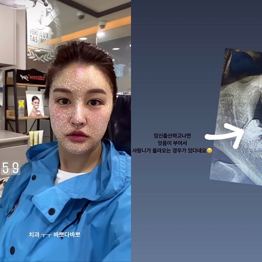 박은지 인스타그램