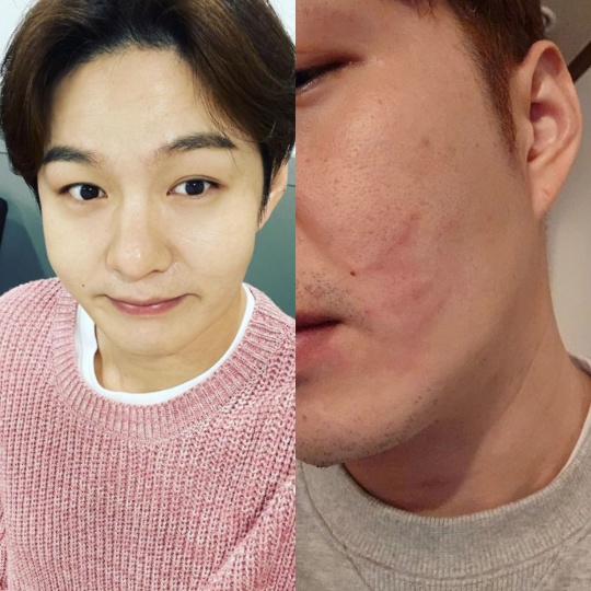 이창섭 채널