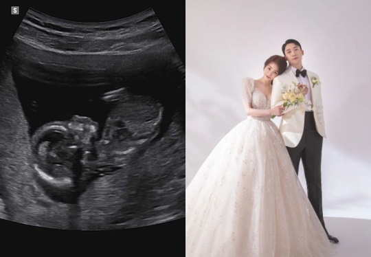 유키스 훈