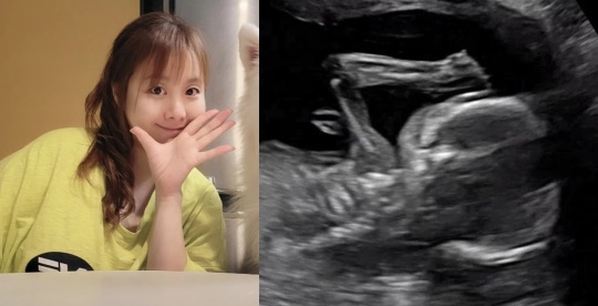 노희지 채널