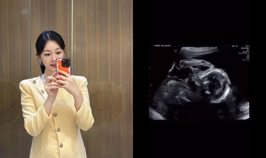 윤지연 아나