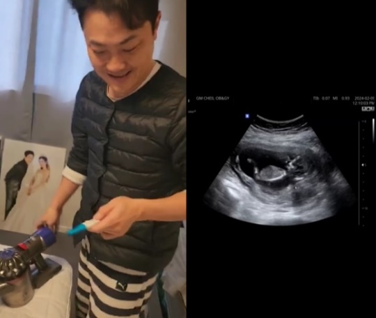 이성진 채널