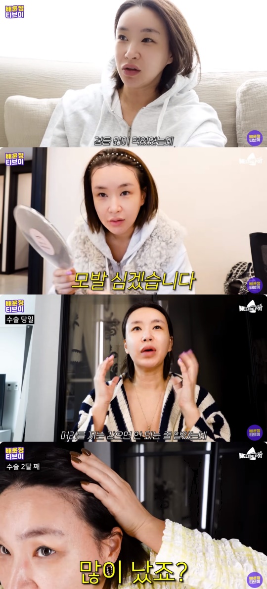 배윤정 유튜브 캡처