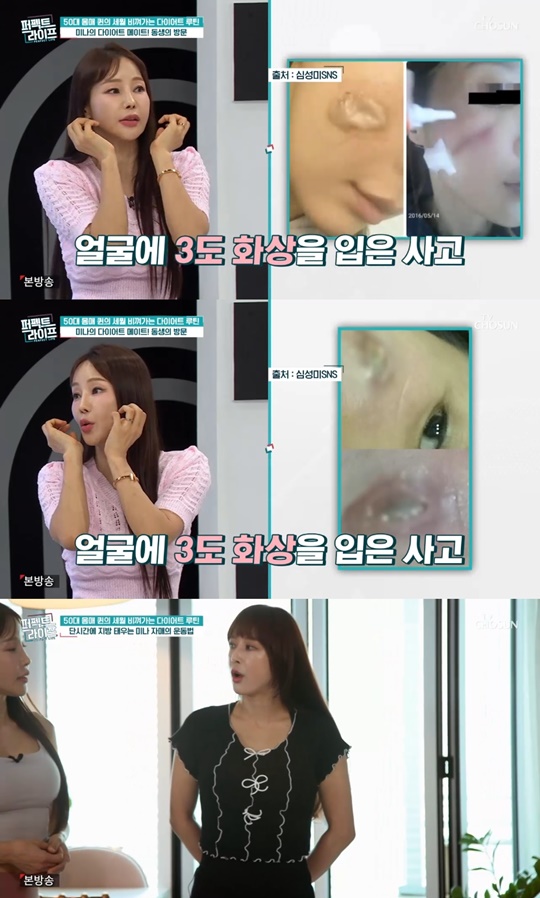 TV조선 '퍼펙트라이프' 캡처