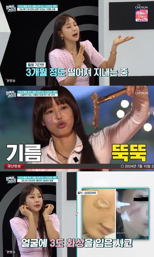 TV조선 '퍼펙트라이프' 캡처