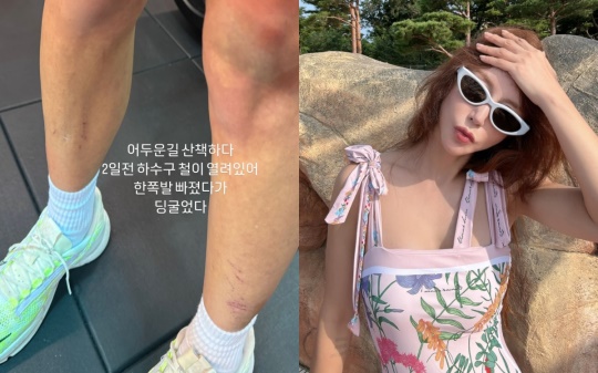 슈 채널 스토리