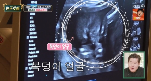KBS2 ‘신상출시 편스토랑’ 방송화면 캡처