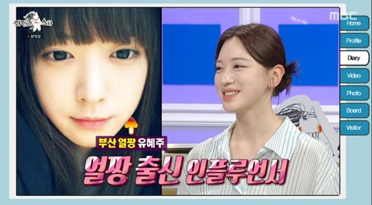MBC '라디오스타' 캡처