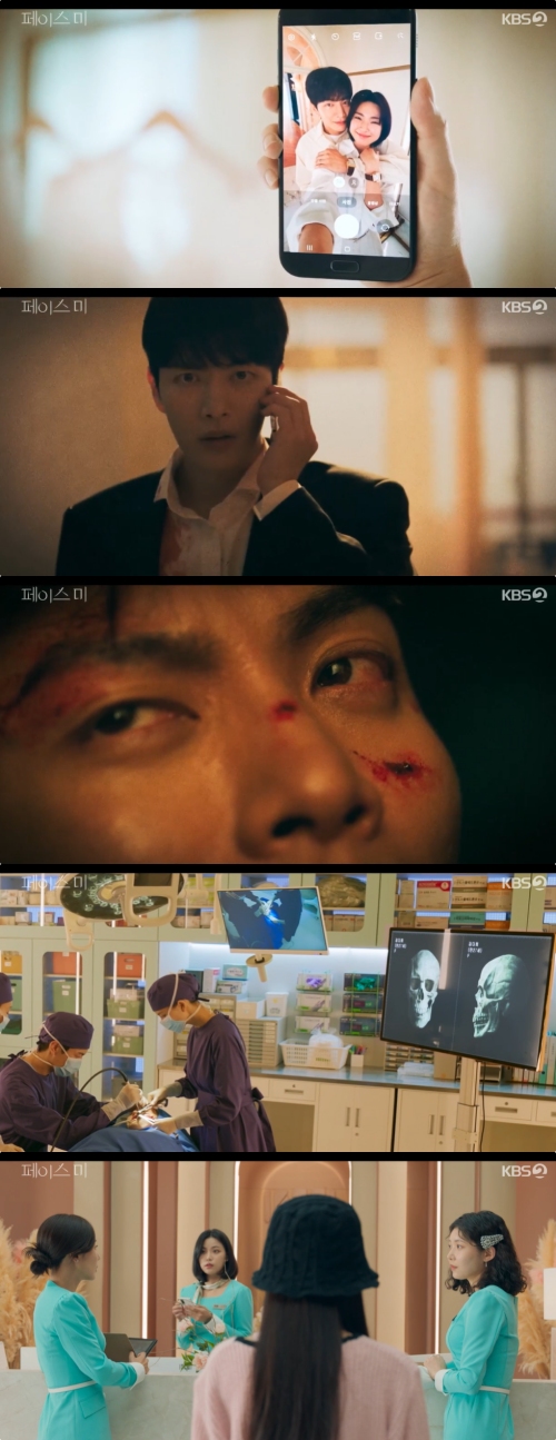 KBS2 '페이스 미' 방송화면 캡처